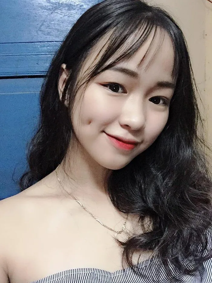 Có má lúm đồng tiền sâu hoắm bị nhầm luôn là vết sẹo trên mặt, girl xinh kể  khổ ai dè gặp rổ người quen