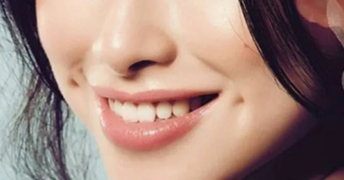 Dự đoán tính cách, vận mệnh của người có má lúm đồng tiền