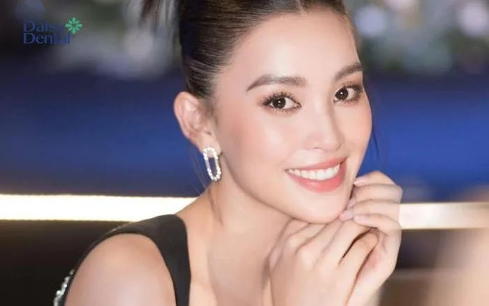 100+ Hình ảnh nụ cười đẹp mang lại năng lượng tích cực