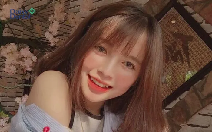 Top 300+ hình ảnh gái xinh răng khểnh cực dễ thương