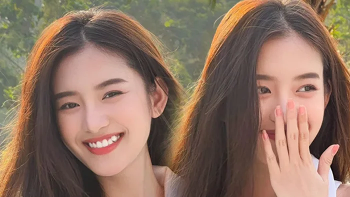 Để răng khểnh đẹp hay xấu? Nên nhổ hay niềng răng khểnh?
