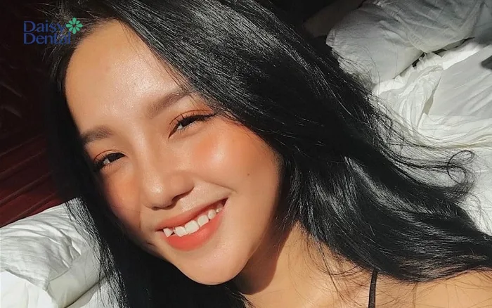 Top 300+ hình ảnh gái xinh răng khểnh cực dễ thương