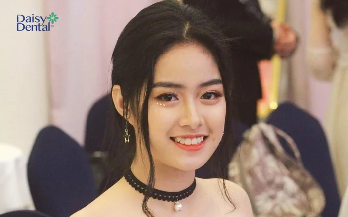 Top 300+ hình ảnh gái xinh răng khểnh cực dễ thương