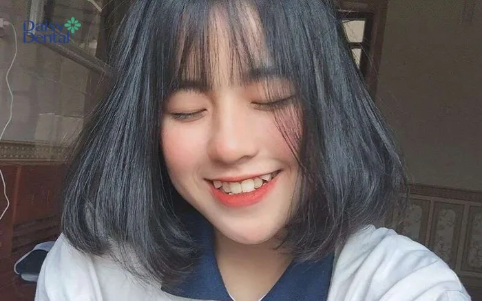 Top 300+ hình ảnh gái xinh răng khểnh cực dễ thương