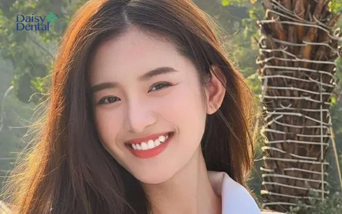 Top 300+ hình ảnh gái xinh răng khểnh cực dễ thương