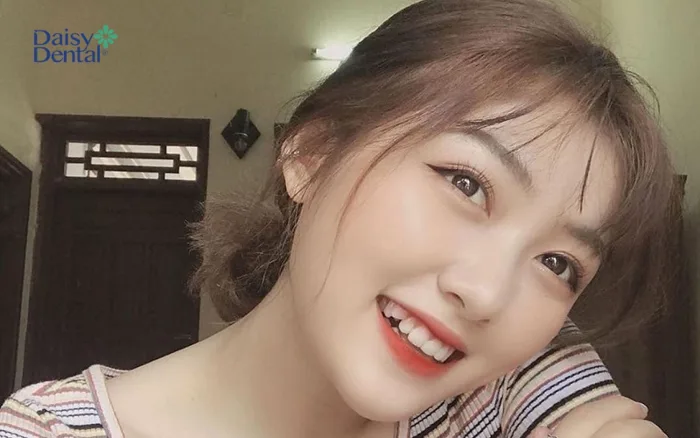 Top 300+ hình ảnh gái xinh răng khểnh cực dễ thương