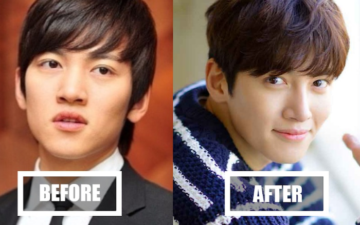 Netizen Hàn so sánh ảnh trước và sau phẫu thuật của Ji Chang Wook - Saostar.vn