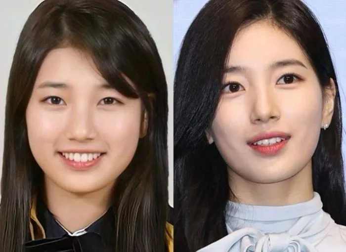 Sự thay đổi ngoại hình của Suzy gây tò mò