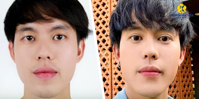 Mắt 1 mí nam xấu hay đẹp? - Keangnam Korea
