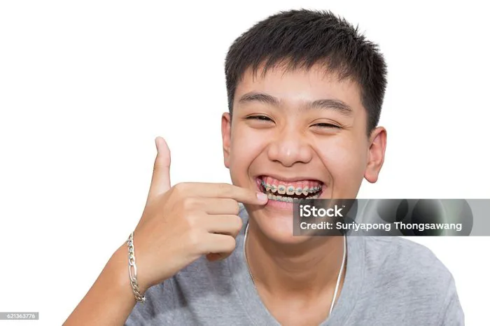 Nụ Cười Đẹp Của Chàng Trai Đẹp Trai Chỉ Vào Răng Niềng Răng Hình ảnh Sẵn có  - Tải xuống Hình ảnh Ngay bây giờ - iStock