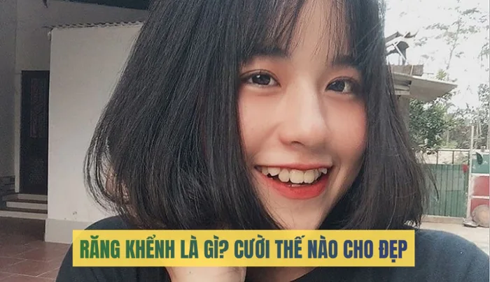 Răng khểnh là gì? Người răng khểnh cười sao cho đẹp