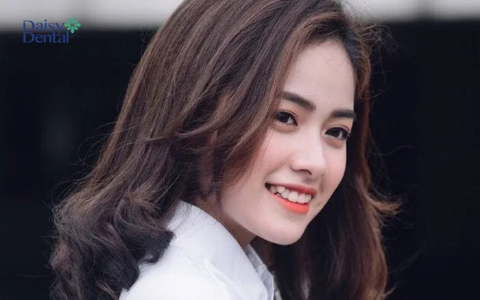 Top 300+ hình ảnh gái xinh răng khểnh cực dễ thương
